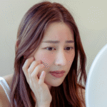 The Best DIY Remedies for Dry Skin to Nourish and Hydrate Naturally